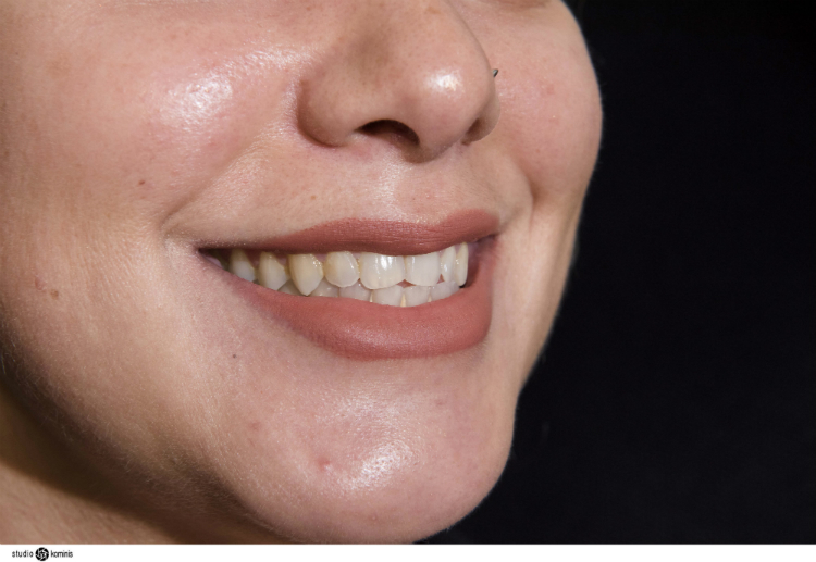 smileworks_016.jpg
