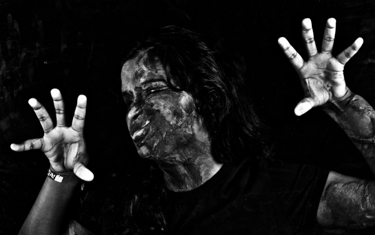 acid-attack-survivors-campaign-03.jpg