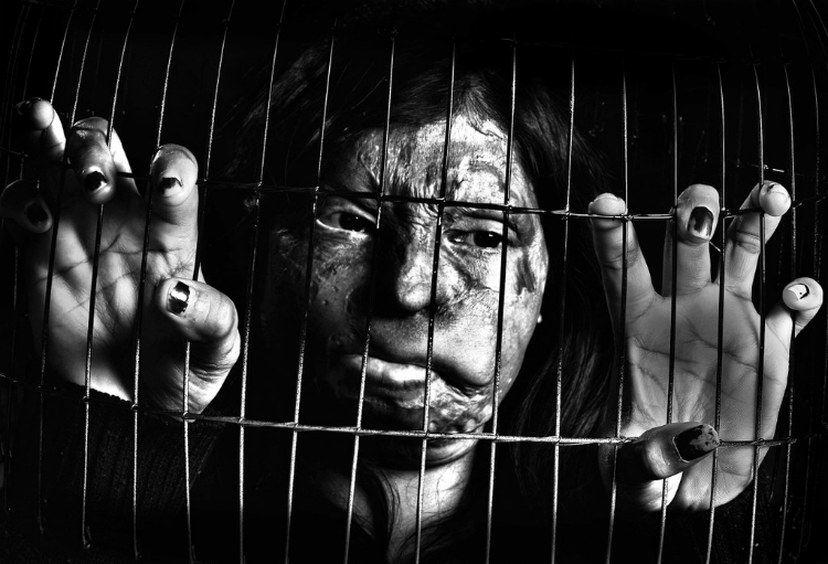 acid-attack-survivors-campaign-04.jpg