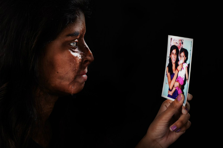 acid-attack-survivors-campaign-05.jpg