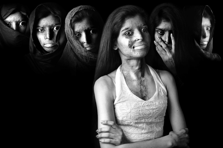 acid-attack-survivors-campaign-08.jpg