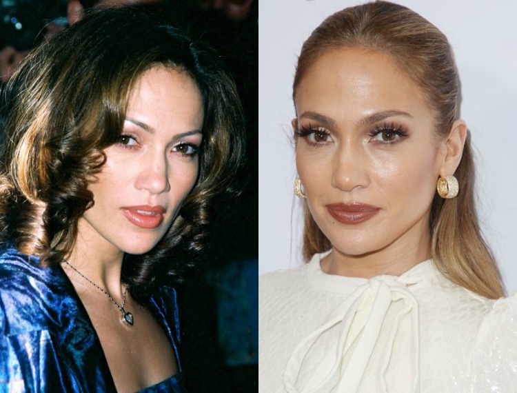 5eyebrowstransformation-03.jpg