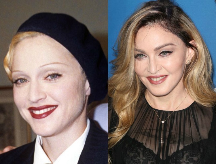 5eyebrowstransformation-04.jpg